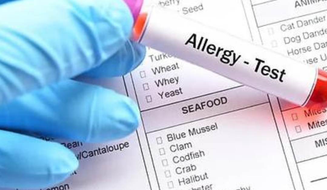 What is the Difference Between Food Allergies vs Food Sensitivities?