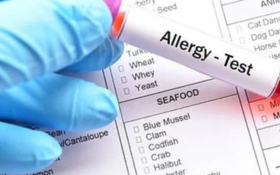 What is the Difference Between Food Allergies vs Food Sensitivities?