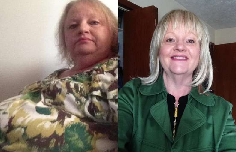 a white woman with who lost 50 pounds using nutrition health works